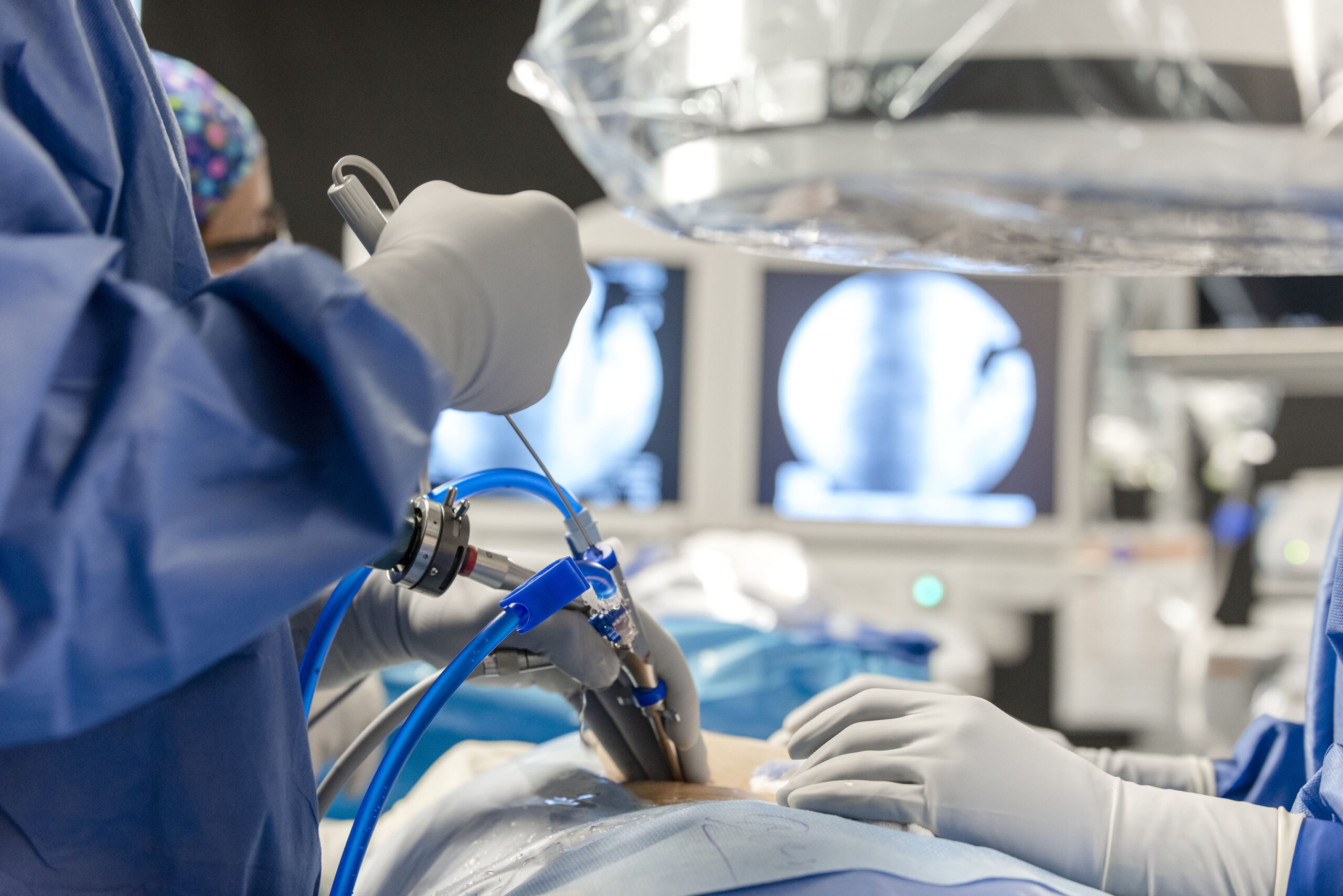 Endoscopic Surgery