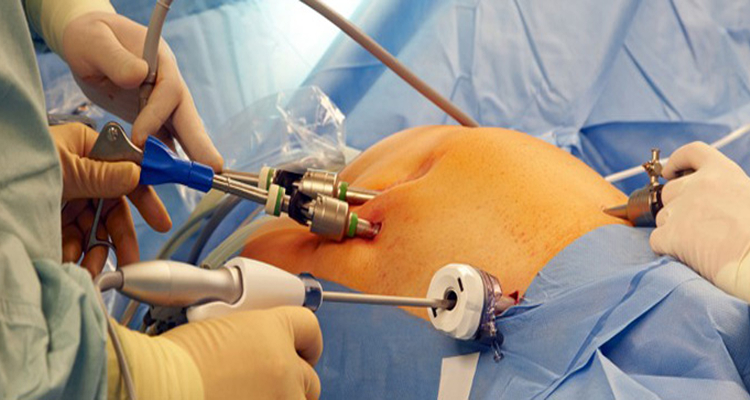 Laparoscopic Uro-Oncology