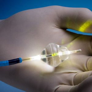 The Future of Urology: Exploring Laser Surgery at UNCE