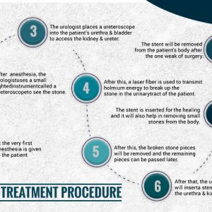 Best Laser surgery in Bhubaneswar Uro Nephro Center of Excellence (UNCE)